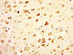 C12ORF68 Antibody in Immunohistochemistry (Paraffin) (IHC (P))
