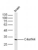 C4orf44 Antibody in Immunohistochemistry (Paraffin) (IHC (P))