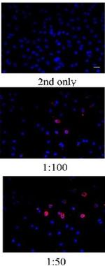 BrdU Antibody in Immunocytochemistry (ICC/IF)