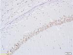 BrdU Antibody in Immunohistochemistry (Paraffin) (IHC (P))