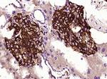 TIMP-1 Antibody in Immunohistochemistry (Paraffin) (IHC (P))