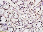 HER2 receptor Antibody in Immunohistochemistry (Paraffin) (IHC (P))