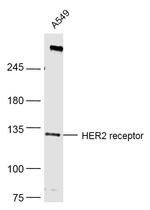 HER2 receptor Antibody in Western Blot (WB)