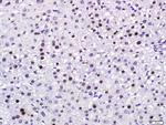 PCNA Antibody in Immunohistochemistry (Paraffin) (IHC (P))