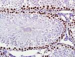 PCNA Antibody in Immunohistochemistry (Paraffin) (IHC (P))