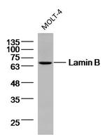 Lamin B Antibody in Western Blot (WB)