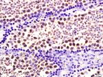 HSP70 Antibody in Immunohistochemistry (Paraffin) (IHC (P))