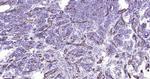 Cytokeratin 19 Antibody in Immunohistochemistry (Paraffin) (IHC (P))