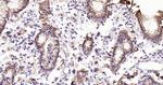Cytokeratin 19 Antibody in Immunohistochemistry (Paraffin) (IHC (P))