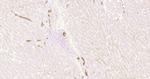 CK7 Antibody in Immunohistochemistry (Paraffin) (IHC (P))