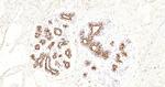 CK7 Antibody in Immunohistochemistry (Paraffin) (IHC (P))