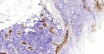 CK7 Antibody in Immunohistochemistry (Paraffin) (IHC (P))