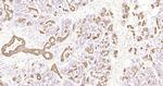 CK7 Antibody in Immunohistochemistry (Paraffin) (IHC (P))