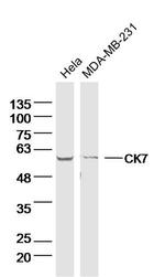 CK7 Antibody in Western Blot (WB)