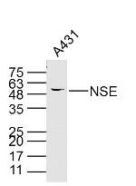 NSE Antibody in Western Blot (WB)