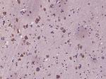 C-erbB-2/HER2 Antibody in Immunohistochemistry (Paraffin) (IHC (P))