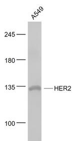 C-erbB-2/HER2 Antibody in Western Blot (WB)