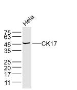 KRT17 Antibody in Western Blot (WB)