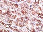 KRT18 Antibody in Immunohistochemistry (Paraffin) (IHC (P))