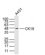 KRT18 Antibody in Western Blot (WB)