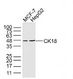 KRT18 Antibody in Western Blot (WB)