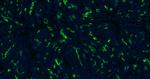CK18 Antibody in Immunohistochemistry (Paraffin) (IHC (P))