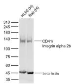 CD41/Integrin alpha 2b Antibody in Western Blot (WB)