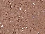 MEK2 Antibody in Immunohistochemistry (Paraffin) (IHC (P))