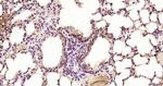 STAT3 Antibody in Immunohistochemistry (Paraffin) (IHC (P))