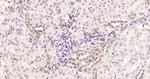 STAT3 Antibody in Immunohistochemistry (Paraffin) (IHC (P))