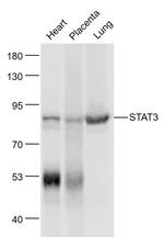 STAT3 Antibody in Western Blot (WB)