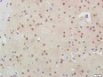 GSK3B Antibody in Immunohistochemistry (Paraffin) (IHC (P))