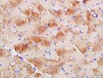 Actin, alpha skeletal muscle Antibody in Immunohistochemistry (Paraffin) (IHC (P))