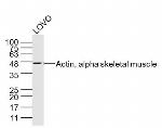 Actin, alpha skeletal muscle Antibody in Western Blot (WB)