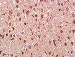 Tau Antibody in Immunohistochemistry (Paraffin) (IHC (P))