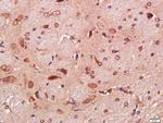 Tau Antibody in Immunohistochemistry (Paraffin) (IHC (P))