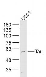 Tau Antibody in Western Blot (WB)