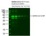 SARS-CoV-2 Nucleocapsid Protein Antibody in Western Blot (WB)