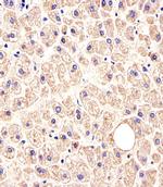 MET/HGFR Antibody in Immunohistochemistry (Paraffin) (IHC (P))