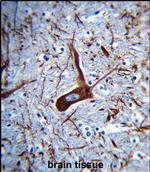 MAP2 Antibody in Immunohistochemistry (Paraffin) (IHC (P))