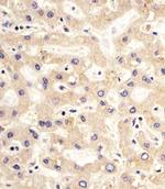 PDK2 Antibody in Immunohistochemistry (Paraffin) (IHC (P))