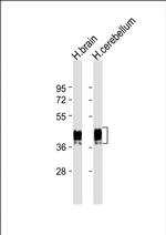 GFAP Antibody in Western Blot (WB)