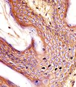 CD44 Antibody in Immunohistochemistry (Paraffin) (IHC (P))