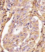 CD44 Antibody in Immunohistochemistry (Paraffin) (IHC (P))