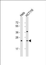RAB8A Antibody in Western Blot (WB)