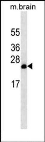 RAB8A Antibody in Western Blot (WB)