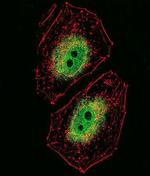 BCL6 Antibody in Immunocytochemistry (ICC/IF)