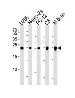 UCHL1 Antibody in Western Blot (WB)