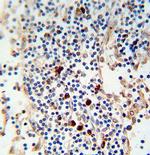 Kappa light chain Antibody in Immunohistochemistry (Paraffin) (IHC (P))