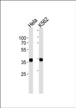 ANXA1 Antibody in Western Blot (WB)